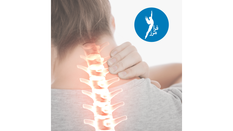 اسپوندیلوز یا ساییدگی  گردن چیست و چه خطراتی دارد؟