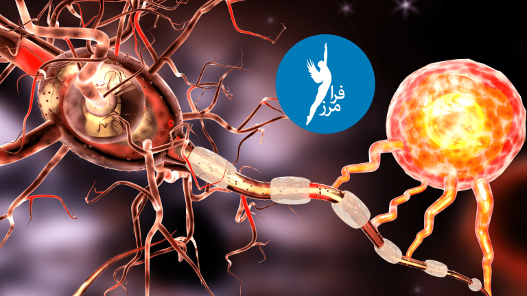 علائم بیماری ام اس(MS)چه هستند؟ آیا به آن مبتلا شده ام؟