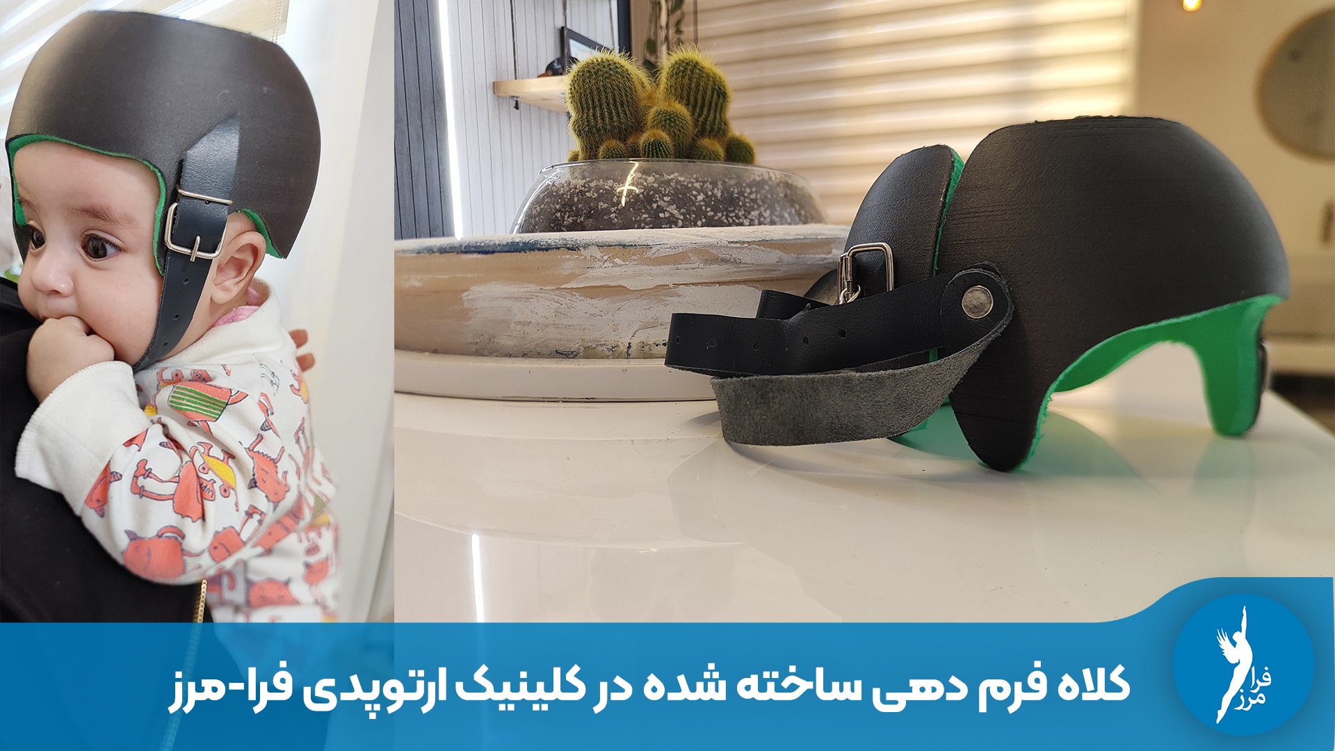 کلاه فرم دهی سر نوزاد چیست و چه کاربردی دارد؟