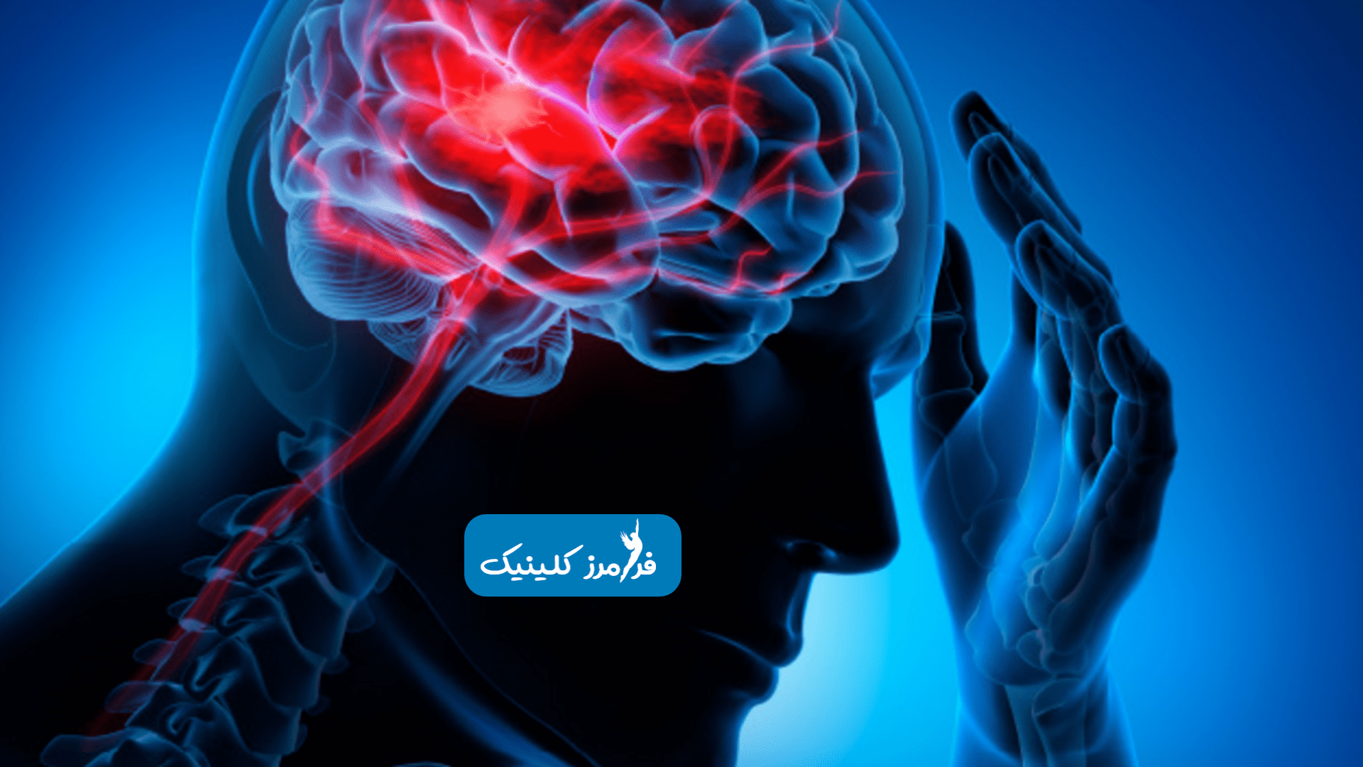 راه بروید تا کمتر سکته کنید