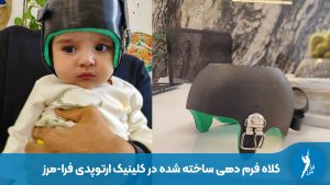 قیمت کلاه فرم دهی سر نوزاد