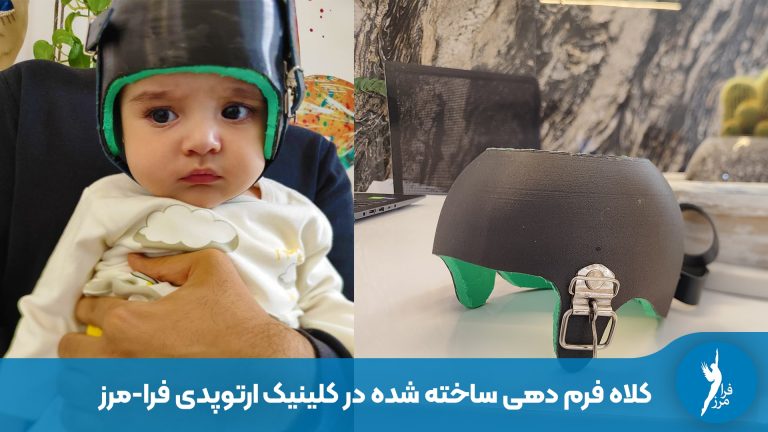 قیمت کلاه فرم دهی سر نوزاد