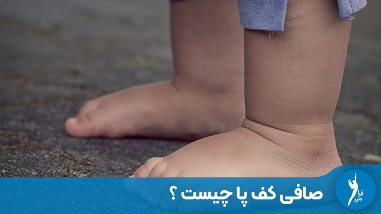 صافی کف پا چیست و چرا نباید آن را نادیده گرفت؟