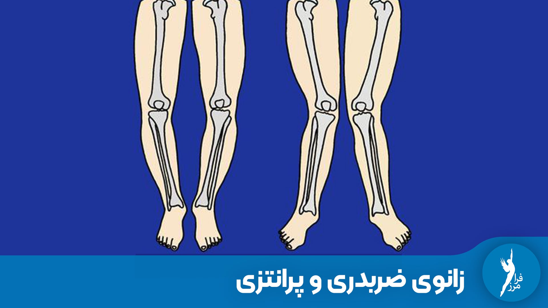 تفاوت زانوی پرانتزی و زانوی ضربدری در چیست؟