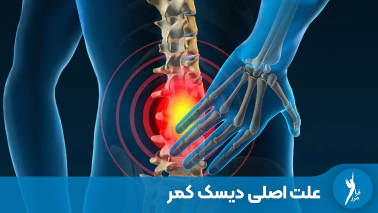 علت اصلی دیسک کمر چیست و در چه سنی بیشتر اتفاق می‌افتد؟