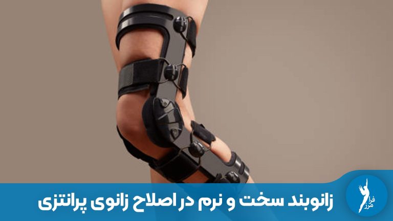 زانوبند سخت یا نرم؛ کدام برای اصلاح زانوی پرانتزی بهتر است؟