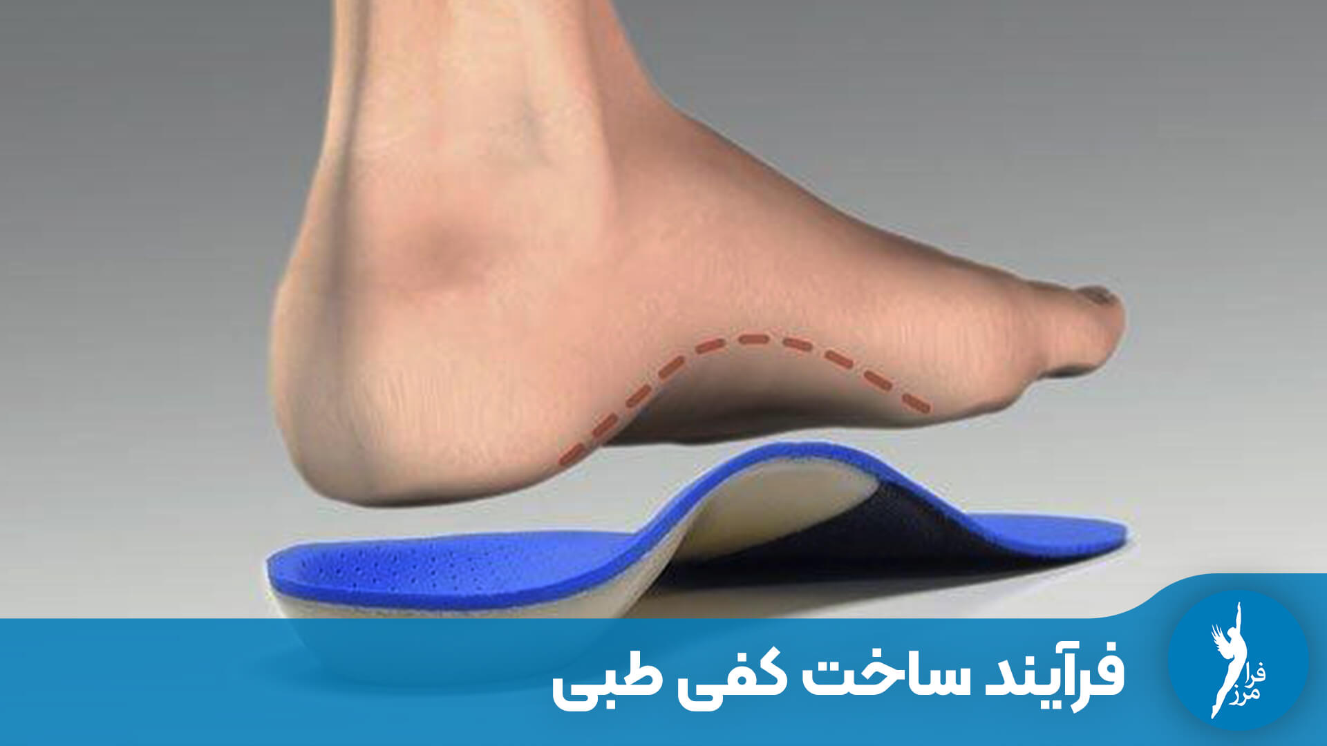 فرآیند ساخت کفی طبی از دید یک متخصص ارتوپدی
