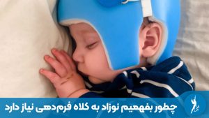 چطور بفهمیم نوزاد به کلاه فرمدهی نیاز دارد