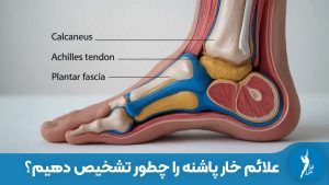 Meta Description: علائم خار پاشنه چیست؟ تشخیص درد صبحگاهی پاشنه، درد بعد از استراحت و تفاوت آن با سایر دردهای پا. راهنمای کامل تشخیص بالینی و خانگی در سایت کلینیک فرامرز.
