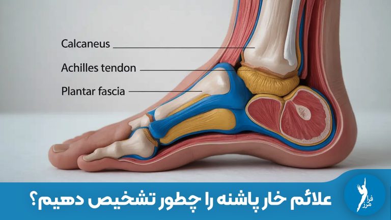 علائم خار پاشنه را چطور تشخیص دهیم؟
