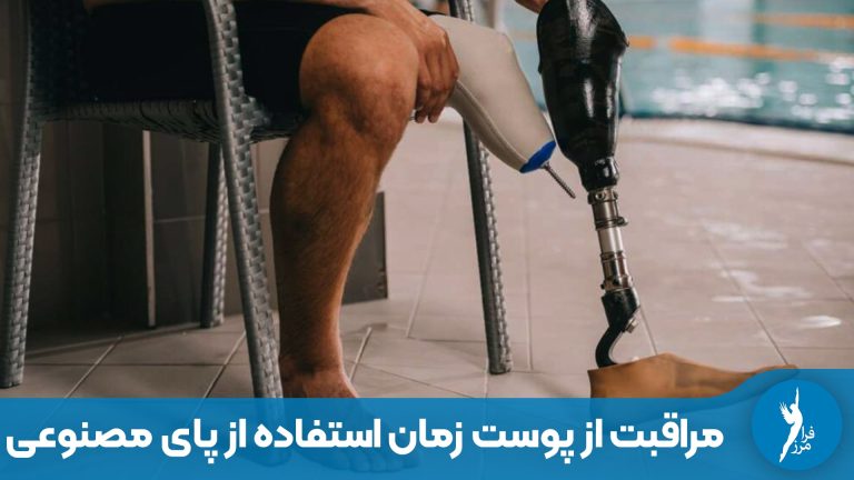 مراقبت از پوست و اندام باقی‌مانده زمان استفاده از پای مصنوعی