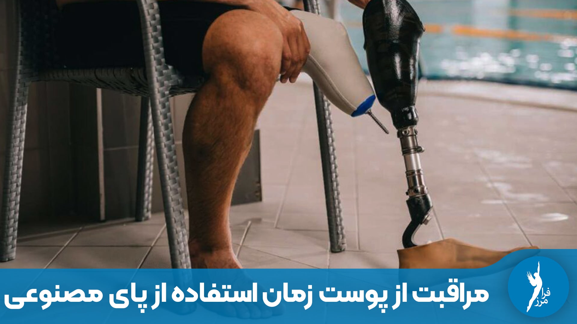 مراقبت از پوست و اندام باقی‌مانده زمان استفاده از پای مصنوعی