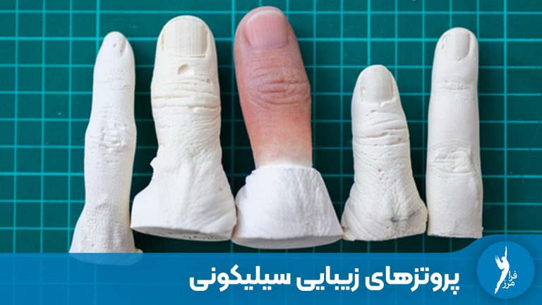 پروتزهای زیبایی سیلیکونی و بازگشت اعتماد به نفس