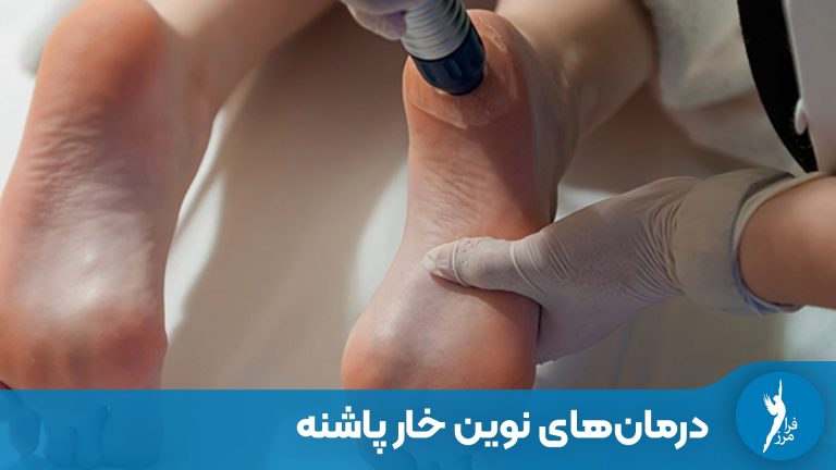 درمان‌های نوین خار پاشنه و درد کف پا