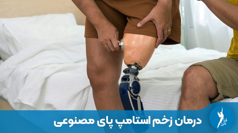 درمان زخم استامپ پای مصنوعی + علت تاول و درد پروتز