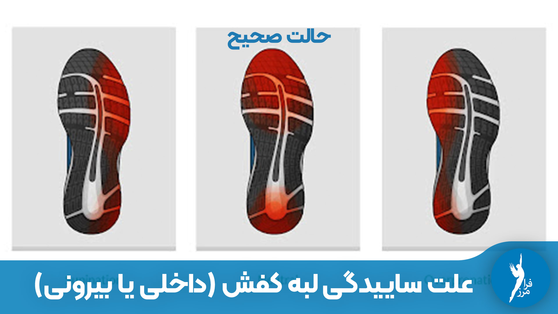 علت ساییدگی لبه کفش (داخلی یا بیرونی) چیست؟