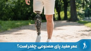 عمر مفید پای مصنوعی