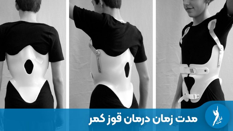 درمان قوز کمر با بریس چقدر طول می‌کشد؟ | جدول زمانی کامل