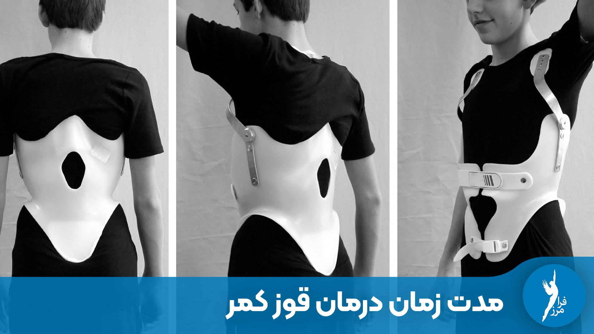 درمان قوز کمر با بریس چقدر طول می‌کشد؟ | جدول زمانی کامل
