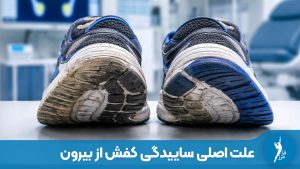 بررسی ۷ علت ساییدگی کفش از بیرون و داخل و ارتباط آن با صافی کف پا و مشکلات ارتوپدی در کلینیک ارتوپدی فنی.