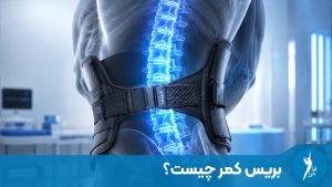 بریس کمر چیست؟ در این مقاله جامع به بررسی انواع کمربندهای طبی، کاربردهای آنها در درمان دیسک کمر و مزایای استفاده از آنها پرداخته‌ایم.