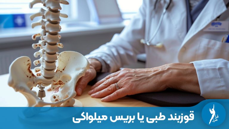 قوزبند طبی یا بریس میلواکی؟ کدام برای درمان قوز کمر بهتر است؟