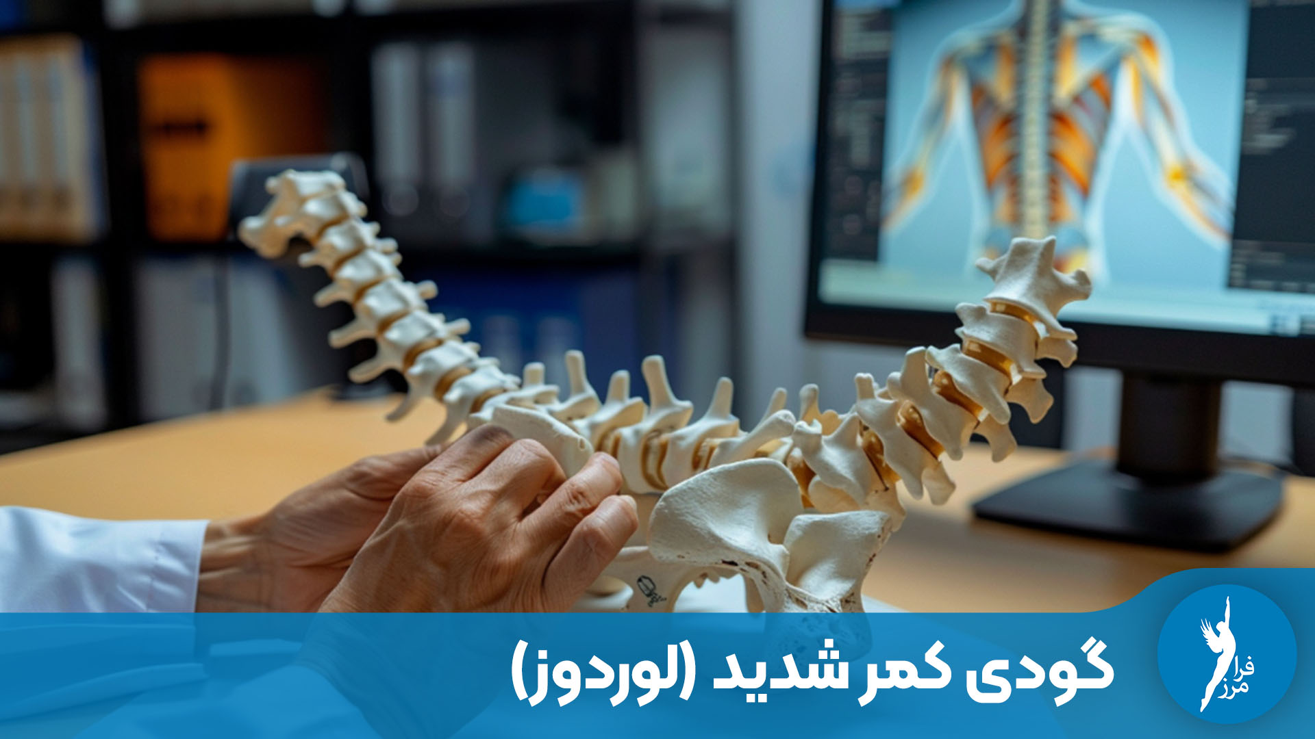 گودی کمر شدید (لوردوز) + علت، علائم و حرکات اصلاحی
